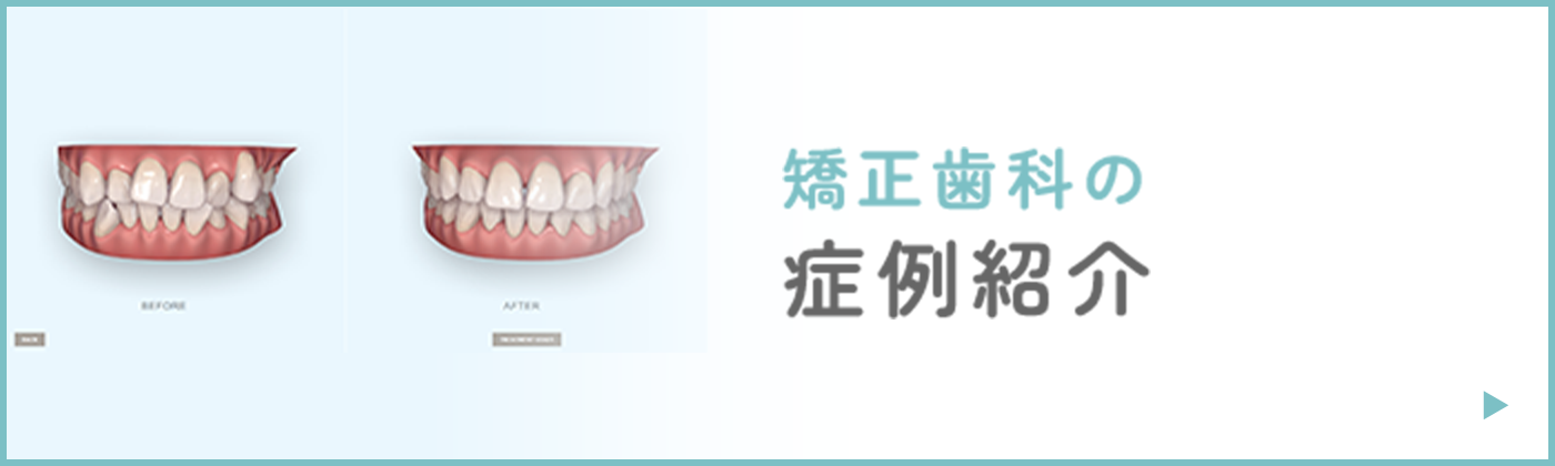 矯正歯科の症例紹介