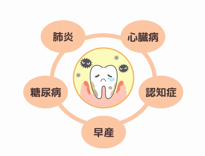 歯周病は全身疾患と関連している？