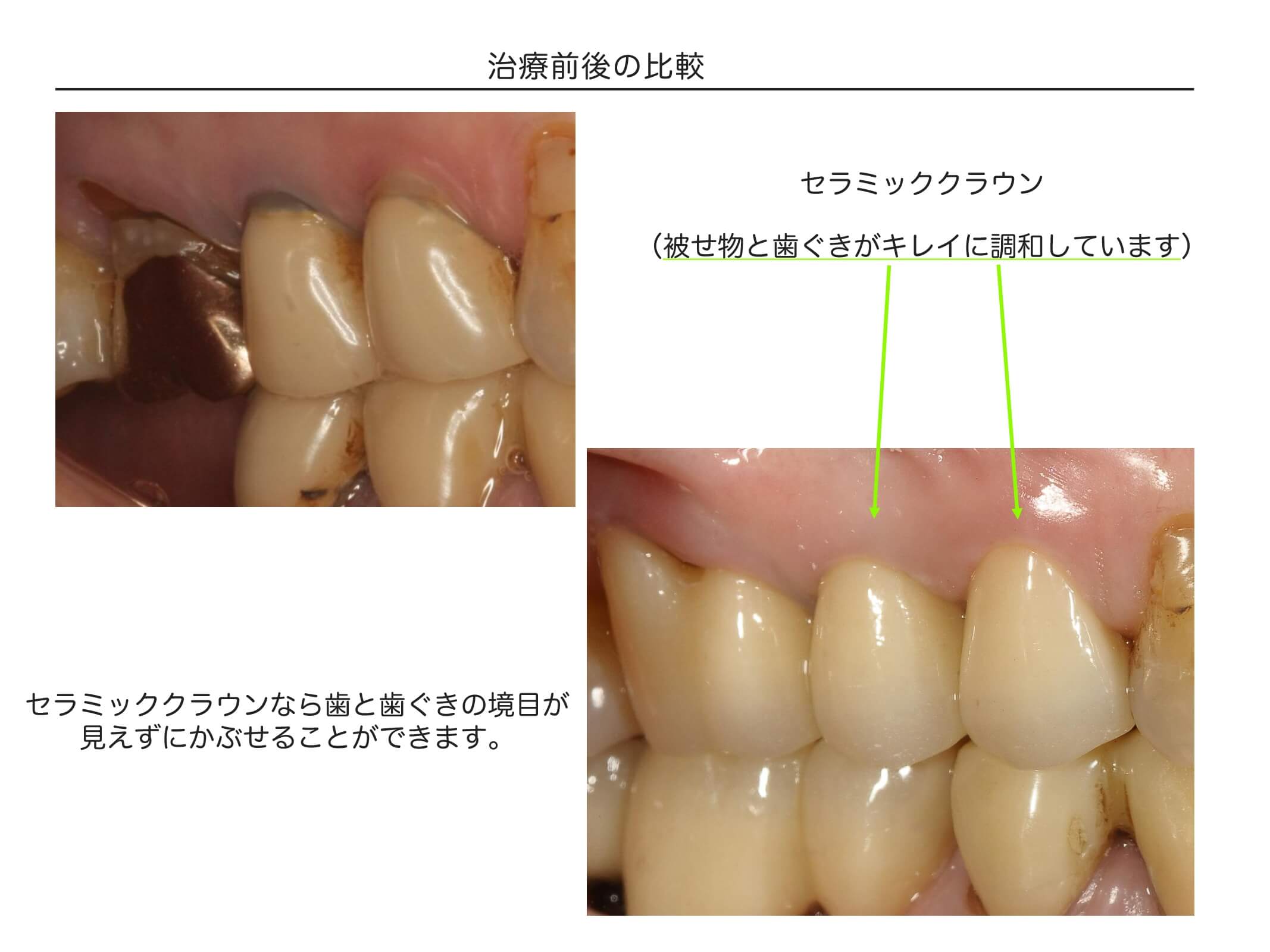 治療前後の比較