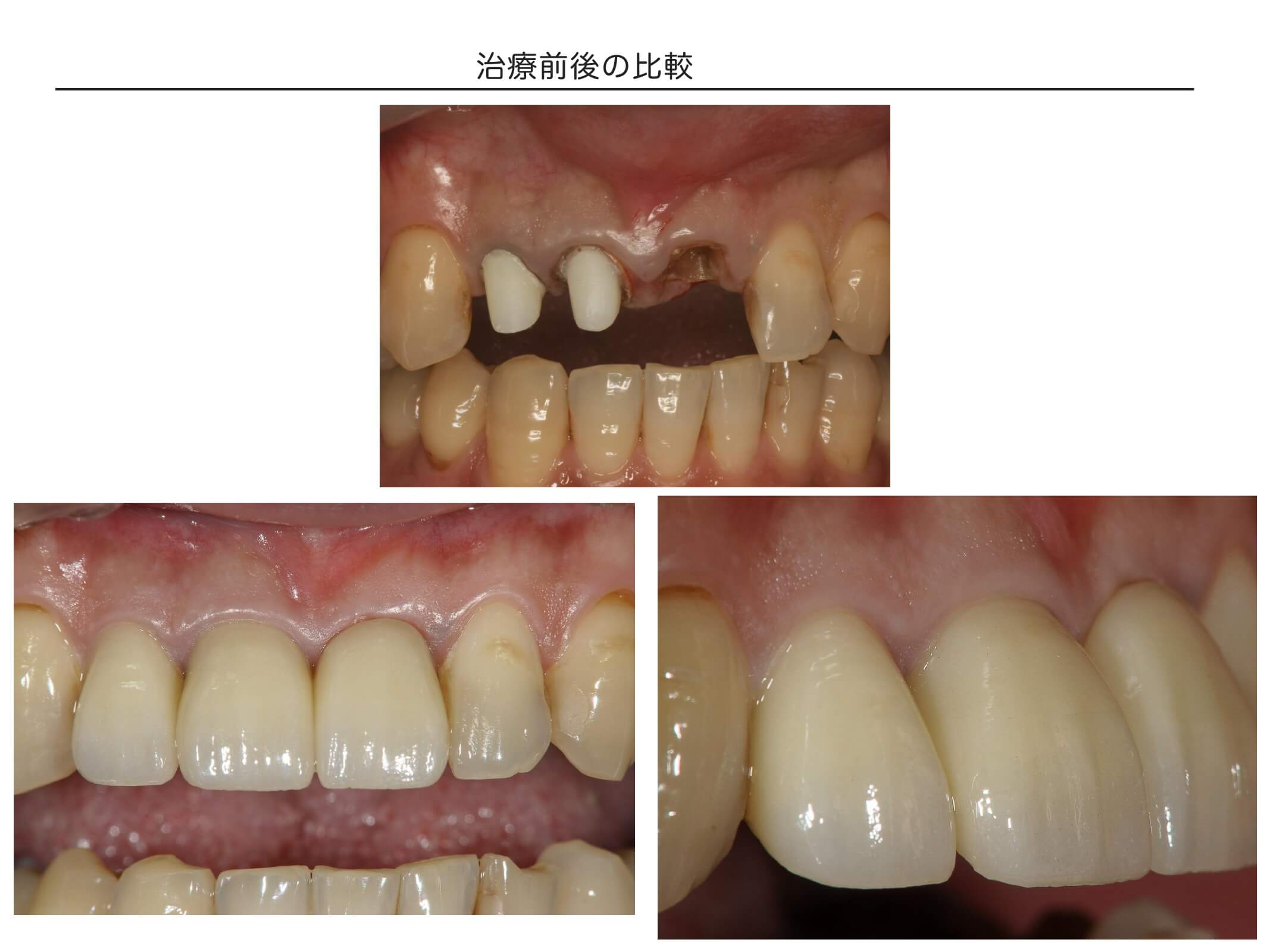 治療前後の比較