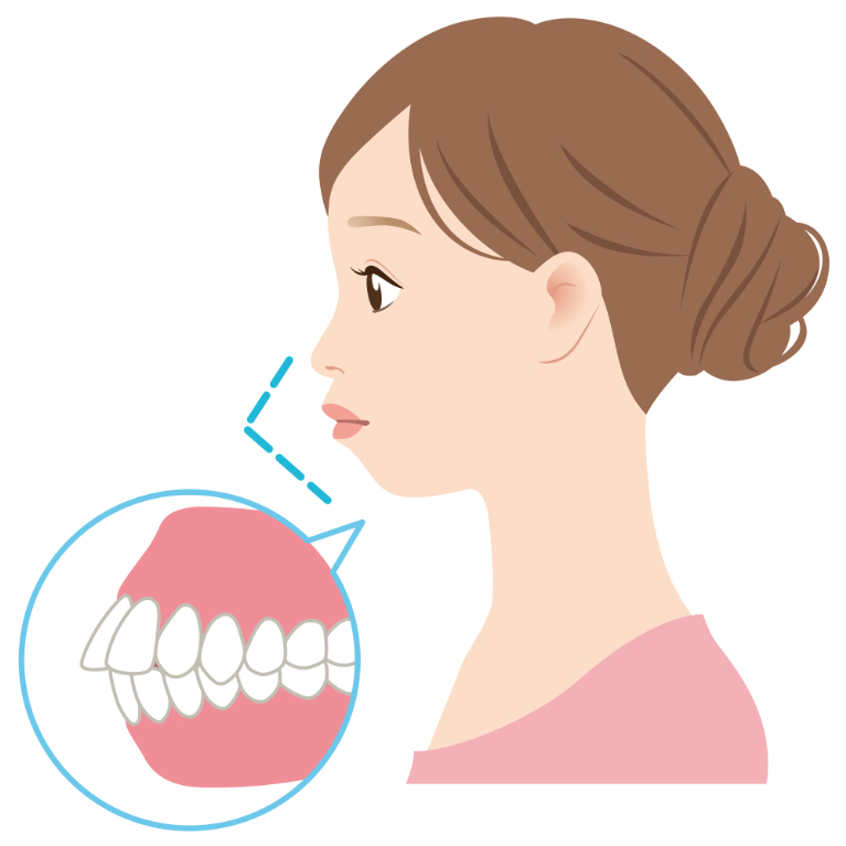 口ゴボ（ゴボ口）の原因
