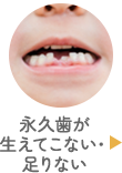 永久歯が生えてこない・足りない