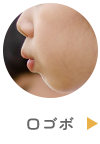 口ゴボ